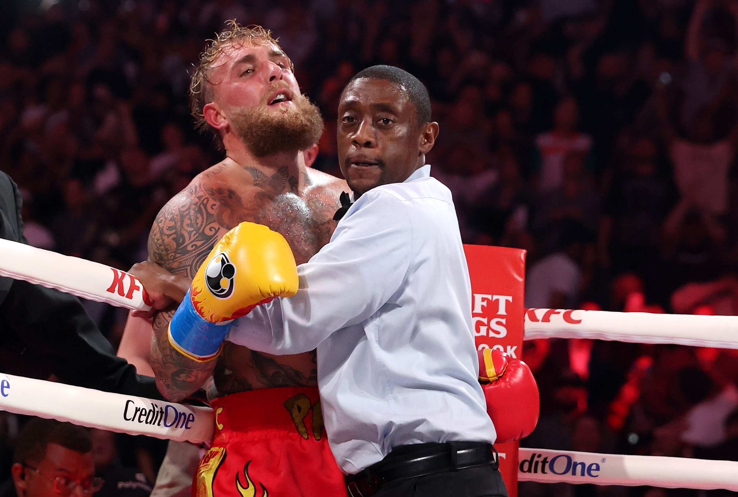 “Double broken jaw”: Jake Paul shows the damage from the Joshua fight