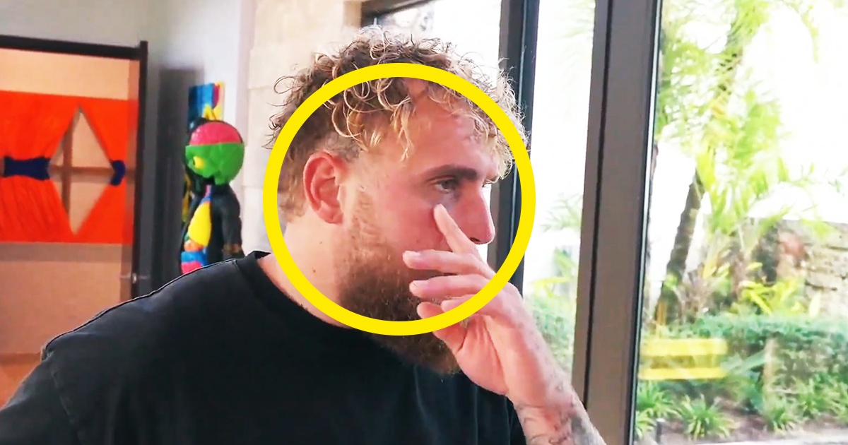 Jake Says What He’ll Weigh vs Joshua — And Shows a Black Eye From ...
