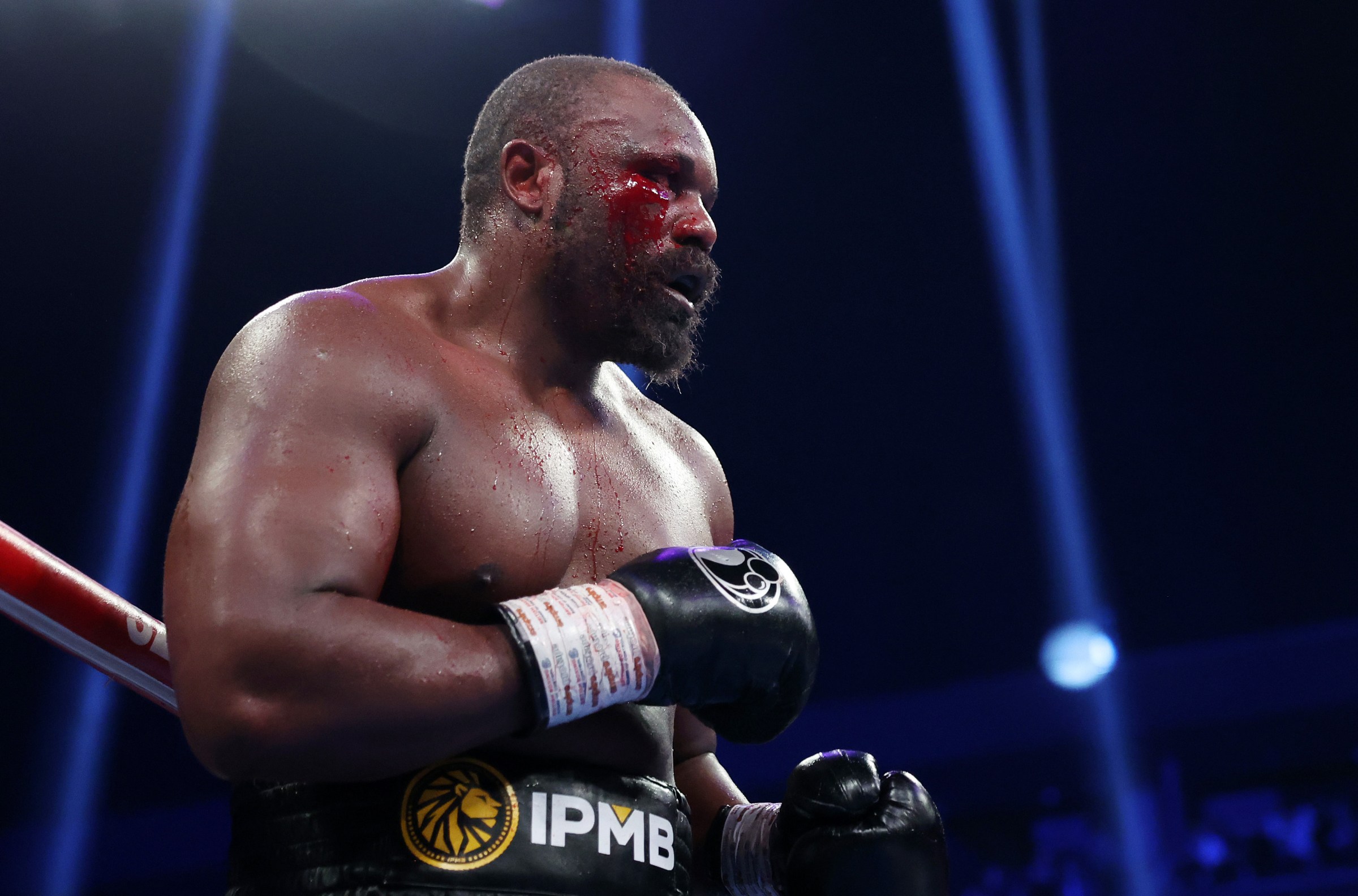 Chisora: “I wanted Whyte again because that’s what the British fans want”