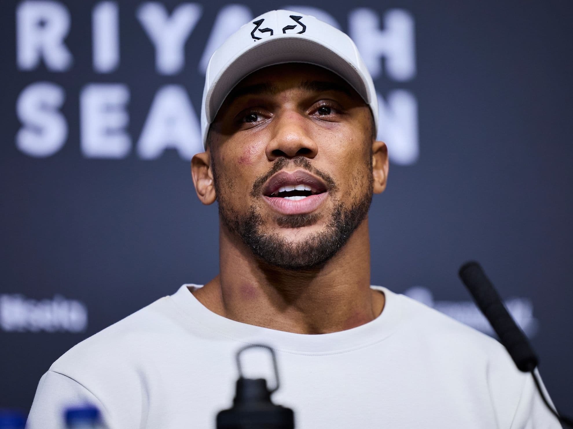 Anthony Joshua hospitalized after car accident in Nigeria